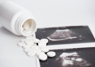 What’s really at stake in the abortion pill case before the Supreme Court